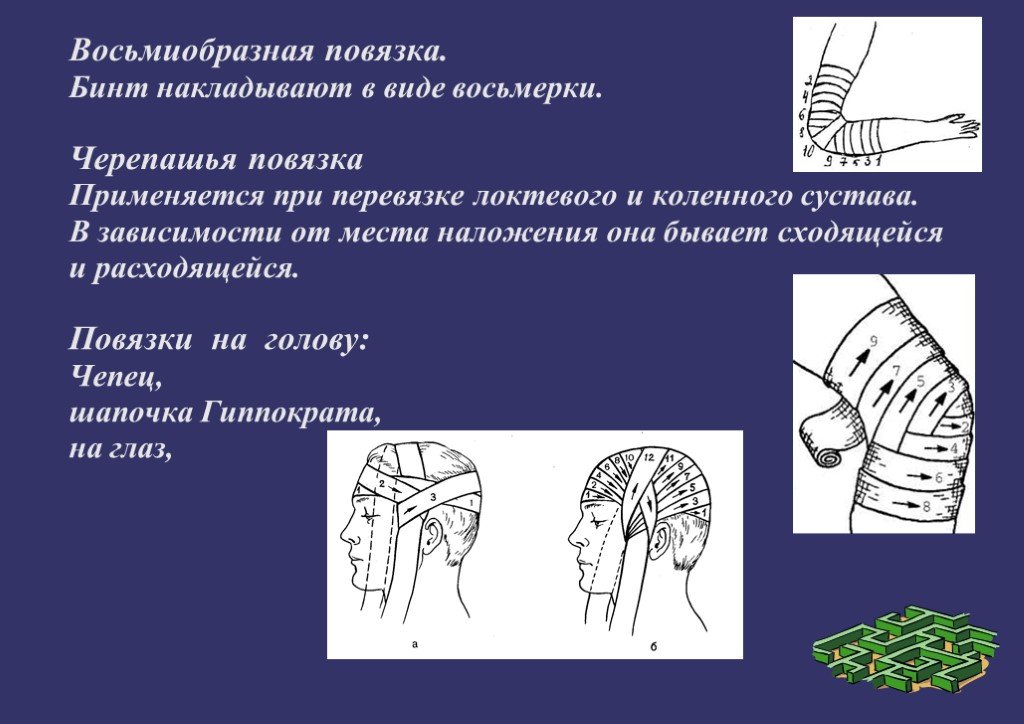 Виды перевязок и способы их наложения с картинками