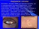 Патогенное значение имеют как взрослые паразиты, так и микрофилярий. Онхоцеркоз проявляется в виде подкожных поражений, связанных с реактивным разрастанием соединительной ткани вокруг погибших и живых гельминтов. Но наиболее характерная черта заболевания — поражение глаз, нередко приводящее к потере