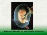 Эмбрион человека на 6-ой неделе развития