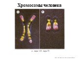 Хромосомы человека. а - пара 1; б - пара 22.