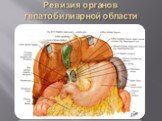 Ревизия органов гепатобилиарной области