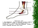Тарзальный канал 1 – большеберцовый нерв; 2 – сухожилие длинного сгибателя пальцев стопы; 3 – медиальная дельтовидная связка; 4 – латеральная лодыжка; 5 – задняя большеберцовая артерия; 6 – мышца, отводящая большой палец стопы.