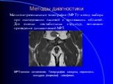 Магнитно-резонансная томография (МРТ)- метод выбора при исследовании паховой и прилежащих областей. Для оценки нестабильных структур, возможно проведение динамической МРТ. МРТ лонного сочленения. Гипертрофия капсулы, неровность контуров (стрелка) - симфизит.