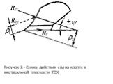 Рисунок 2.- Схема действие сил на корпус в вертикальной плоскости ZOХ