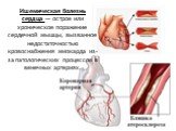Ишемическая болезнь сердца — острое или хроническое поражение сердечной мышцы, вызванное недостаточностью кровоснабжения миокарда из-за патологических процессов в венечных артериях.