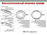 Веноокклюзивный механизм эрекции. 100-110 мм.рт.ст.