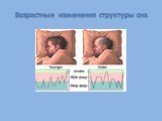 Возрастные изменения структуры сна