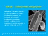 E.Coli – убиквотный оппортунист. Кишечная палочка – широко распространенная условно-патогенная бактерия со сложной антигенной структурой, способная вызвать инфекционное поражение любой системы и органа, например цистит.