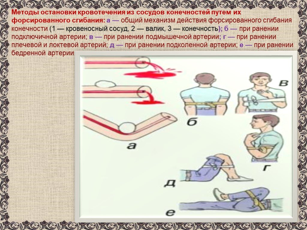 Технологическая карта мероприятия учебного занятия первая помощь при кровотечениях