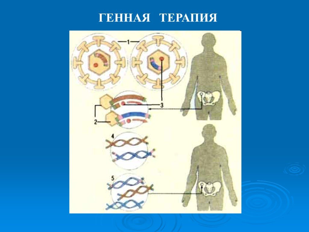 Генная терапия. Генная терапия картинки. Генная терапия кратко. Герментативная генная терапия.