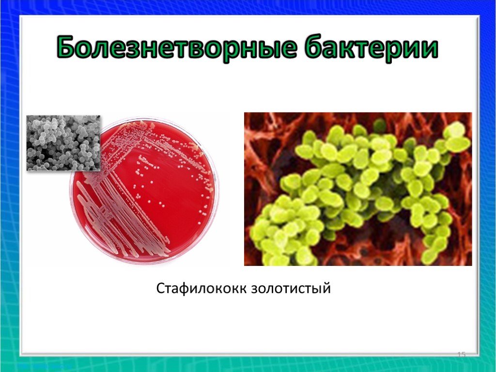 Общая характеристика бактерий 7 класс биология презентация. Болезнетворные бактерии роль в природе. Роль стафилококков в природе. Общая характеристика бактерий презентация. Роль болезнетворных бактерий в природе и жизни человека.