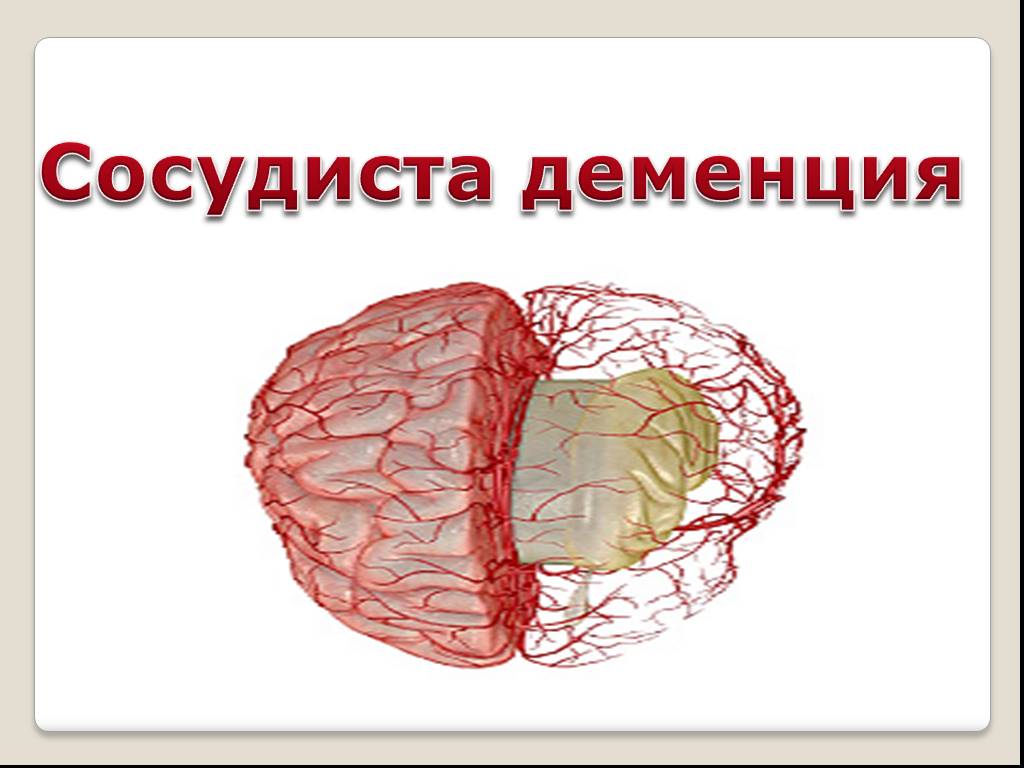 Сосудистая деменция. Мозг сосудистая деменция. Ишемическая сосудистая деменция. Сосудистая деменция презентация.