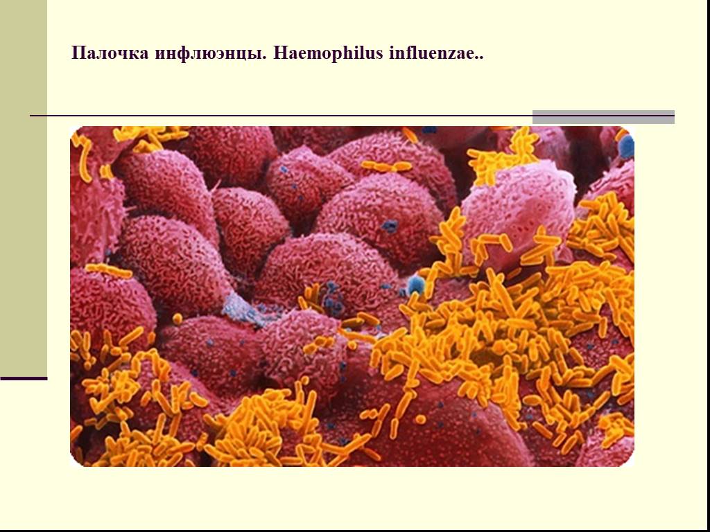 Haemophilus influenzae 10. Бактерии Haemophilus influenzae. Гемофильная инфекция возбудитель. Гемофильная палочка микробиология. Палочка инфлюэнцы.