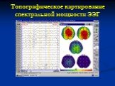 Топографическое картирование спектральной мощности ЭЭГ