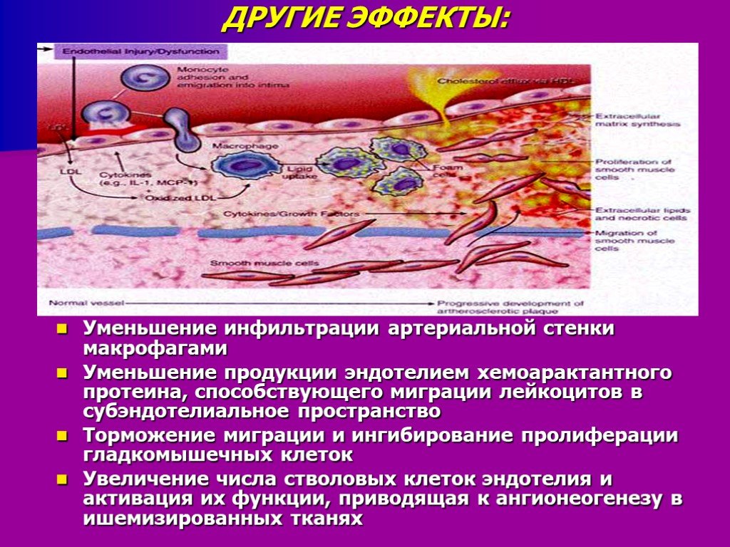 Эффект сокращения. Поведение гладкомышечных клеток при атеросклерозе:. Миграция гладкомышечных клеток. Пролиферация клеток эндотелия. Атеросклероз пролиферация.