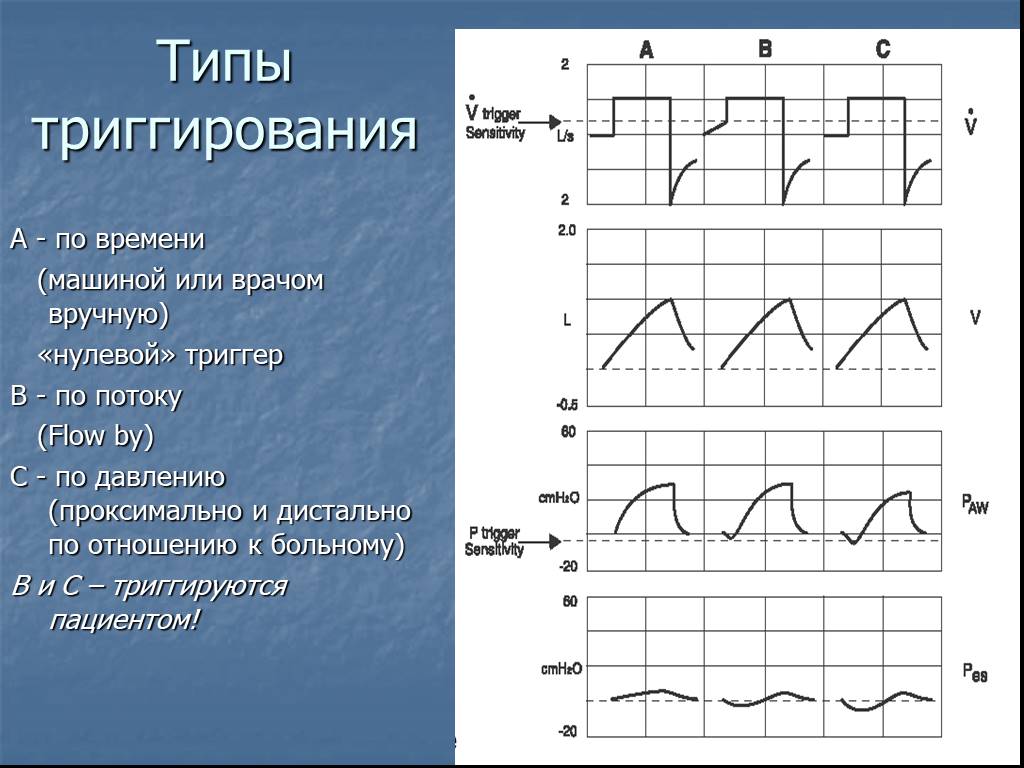 Типы раз. Триггер ИВЛ. Триггер по потоку ИВЛ. ИВЛ параметры триггер. Триггер вентиляции в ИВЛ.