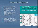 Volume Assist Control. f – число дыханий (12) V t - дыхательный объем (600 мл) F - пиковый поток (40 л/мин) PEEP – давление в конце выдоха (5 cm H2O) Пауза вдоха - 0 Тревоги по объему и ограничение по давлению Sensivity – 3 cm H2O, 2 л/мин ЧД – не менее f. Flow-controlled Volume-cycled, time-cycled 