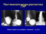 Рентгенологическая диагностика ГЭР. Заброс бария из желудка в пищевод – 61,6%