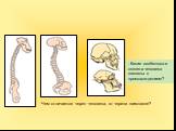 - Какие особенности скелета человека связаны с прямохождением? Чем отличается череп человека, от черепа шимпанзе?