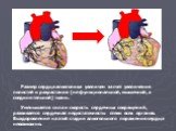 Размер сердца алкоголика увеличен за счет увеличения полостей и разрастания (не функциональной, мышечной, а соединительной) ткани. Уменьшается сила и скорость сердечных сокращений, развивается сердечная недостаточность: отеки всех органов. Выздоровление на этой стадии алкогольного поражения сердца н