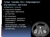 Тупые травмы без повреждения внутренних органов Забрюшинные гематомы. Чаще всего бывают следствием переломов костей таза Источниками кровотечения являются повреждения венозных сплетений и магистральных сосудов тазовой области, сосудов костей таза