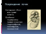 Повреждение почек. Составляет 7 % от всех травм живота. Особенно подвержены травме почки при гидронефрозе, пионефрозе, поликистозе