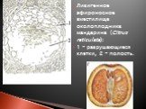 Лизигенное эфироносное вместилище околоплодника мандарина (Citrus reticulata): 1 - разрушающиеся клетки, 2 - полость.