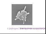 C.perfringens. Электронная микроскопия