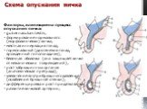 Факторы, влияющие на процесс опускания яичка: gubernaculum testis; формирование нормального (морфологически) яичка; местная иннервация гонад; гормональный (дисгенезия гонад, врожденный гипогонадизм); белочная оболочка (она защищает яичко от механических повреждений); рост забрюшинных органов (анатом