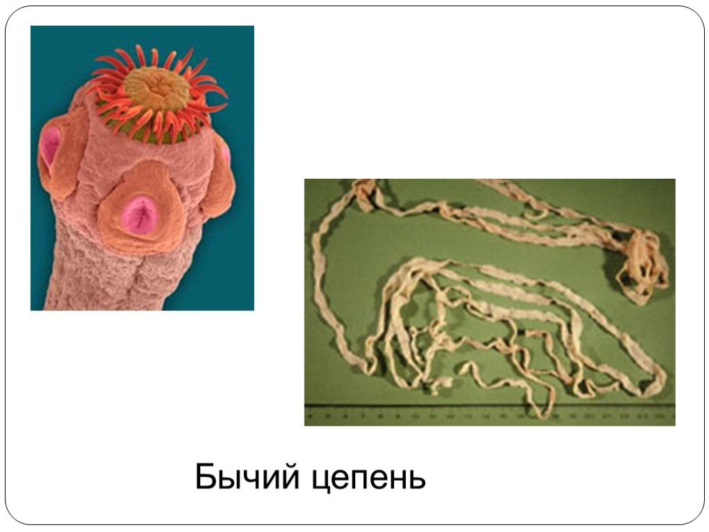 Плоские черви паразиты. Бычий цепень плоский червь. Паразитический червь бычий цепень. Черви паразиты бычий цепень. Эндопаразиты бычий цепень.