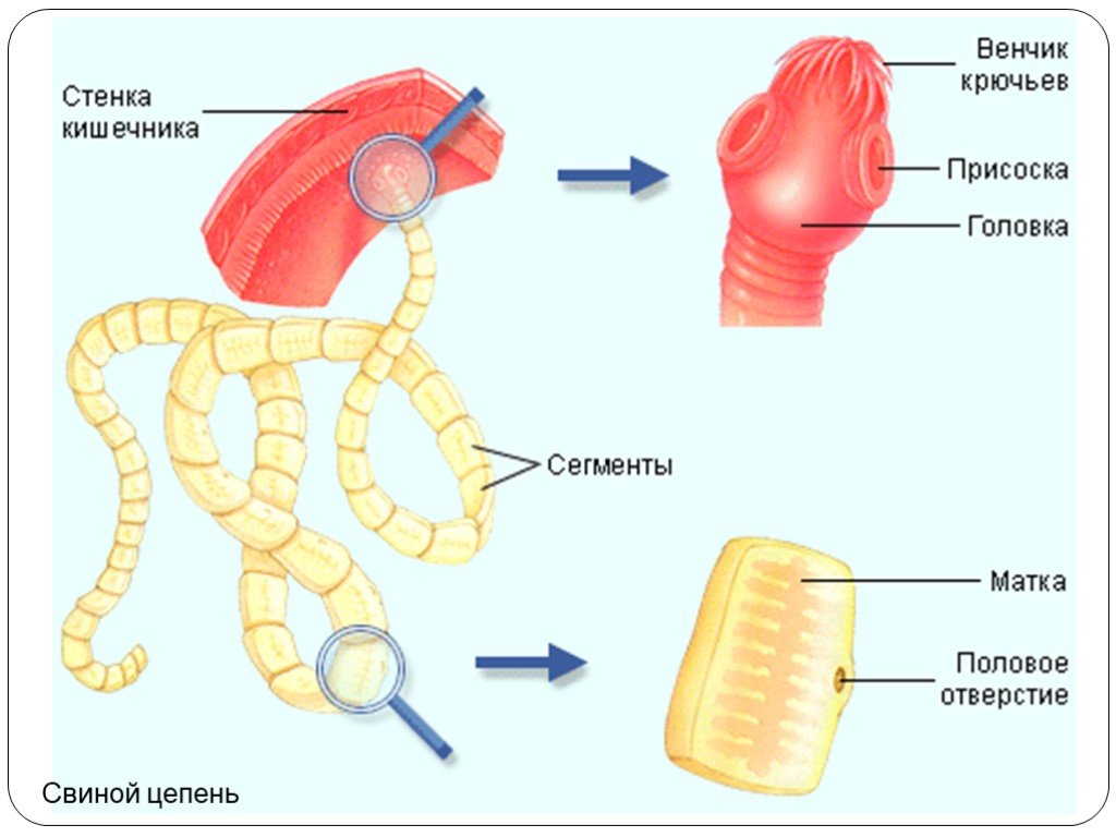 Свиной цепень. Строение головки ленточного червя. Строение головки свиного цепня. Бычий цепень и свиной цепень строение. Внутреннее строение бычьего цепня.