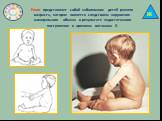 Рахит представляет собой заболевание детей раннего возраста, которое является следствием нарушения минерального обмена в результате недостаточного поступления в организм витамина D