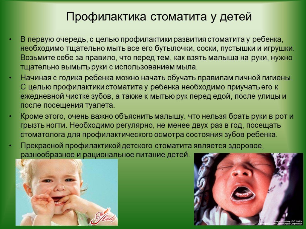 Во рту малыша температура. Профилактика стоматита. Стоматит у детей симптомы.