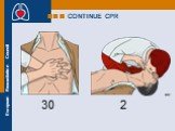 CONTINUE CPR 30 2