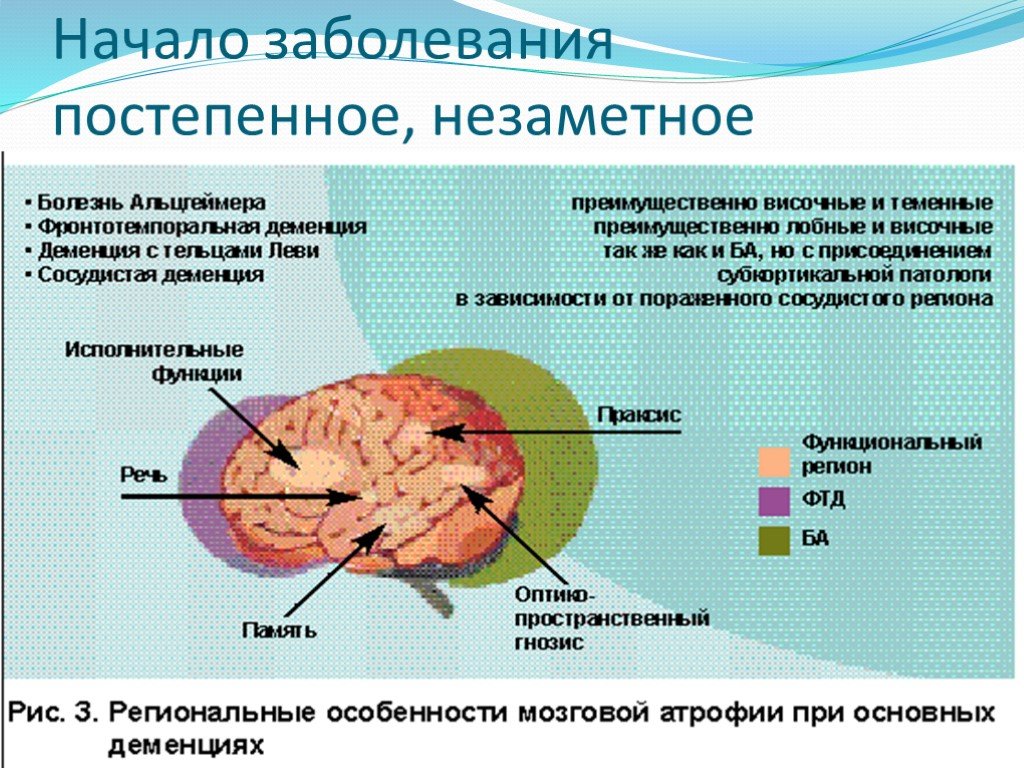 Заболевания деменция болезнь. Изменения мозга при деменции. Поражение мозга при деменции. Локализация поражения при болезни Альцгеймера. "Нарушения при болезни Альцгеймера.