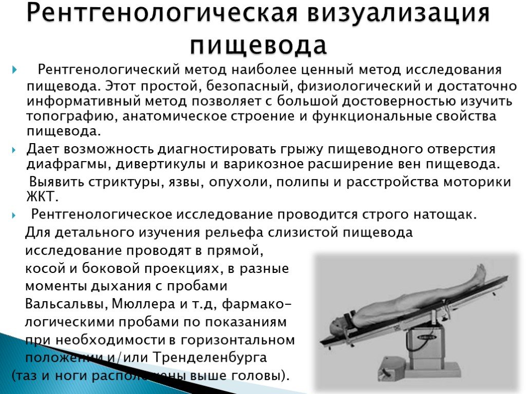 Рентгеноскопия пищевода и желудка в положении тренделенбурга что это такое фото