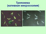 Трепонема (нативная микроскопия)