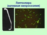 Лептоспира (нативная микроскопия)