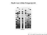 http://www.mun.ca/biology/scarr/DNA_fingerprinting.htm. Multi-loci DNA Fingerprint