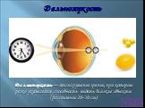 Дальнозоркость. Дальнозоркость — это нарушение зрение, при котором резко ухудшается способность видеть близкие объекты (расстояние 20-30 см).