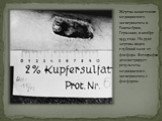 Жертва нацистского медицинского эксперимента в Равенсбрюк, Германия, в ноябре 1943 года. На руке жертвы виден глубокий ожог от фосфора. Фотография демонстрирует результаты медицинского эксперимента с фосфором.