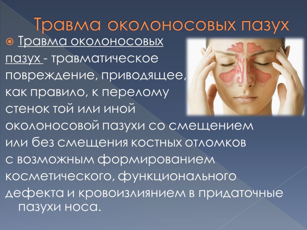 Заболевания придаточных пазух носа. Травмы околоносовых пазух. Травмы носа и придаточных пазух. Травмы носа и пазух носа.