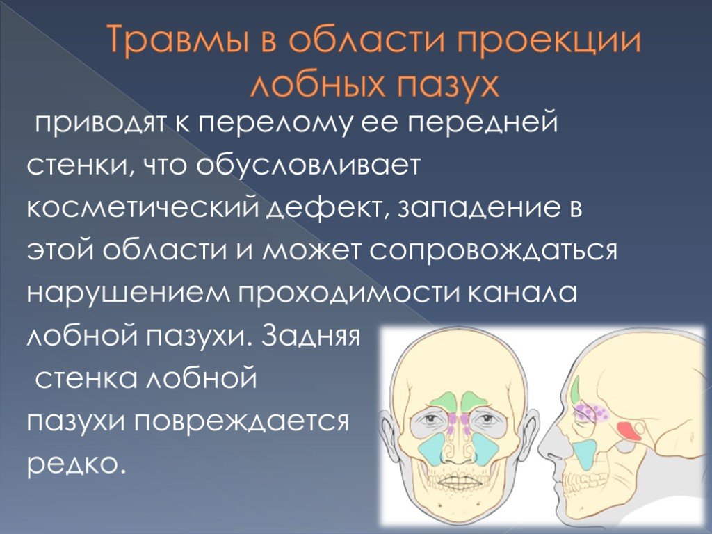 Стенки пазух. Травмы носа и околоносовых пазух. Травмы носа и придаточных пазух. Травмы в области проекции лобных пазух.