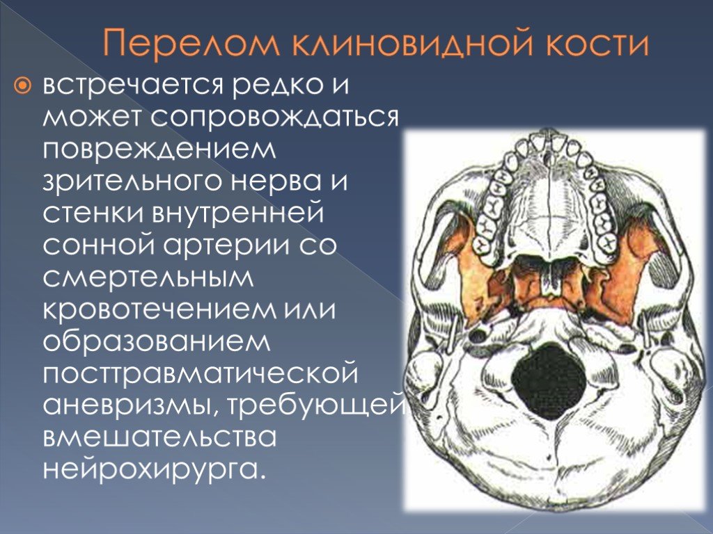 Травмы носа и околоносовых пазух презентация