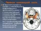 Перелом клиновидной кости. встречается редко и может сопровождаться повреждением зрительного нерва и стенки внутренней сонной артерии со смертельным кровотечением или образованием посттравматической аневризмы, требующей вмешательства нейрохирурга.