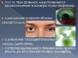 Часто при травмах лица появляются кровоизлияние в камеры глаза (гифемы), смещение глазного яблока (энофтальм), сдавление глазодвигательных мышц (диплопия), сопровождающиеся понижением зрения, вплоть до его полной потери (амовроз).