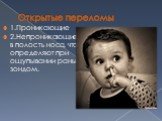 Открытые переломы. 1.Проникающие 2.Непроникающиев полость носа, что определяют при ощупывании раны зондом.