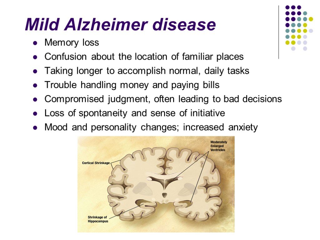 Презентация по болезни альцгеймера