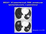 BRCA1+ АТ-резистентный РМЖ: уникальная чувствительность к цисплатину! Moiseyenko et al., 2010