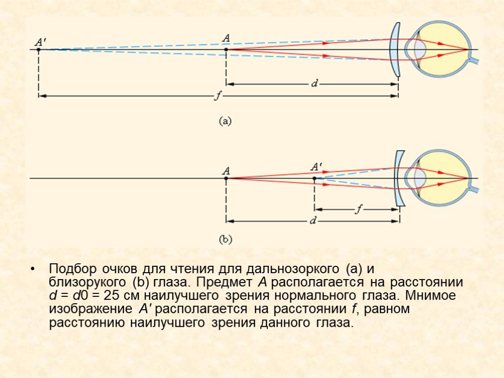Расстояние очков. Расстояние наилучшего зрени. Изображение предмета для дальнозоркого глаза. Мнимое изображение и глаз. Изображение предмета в нормальном глазе.